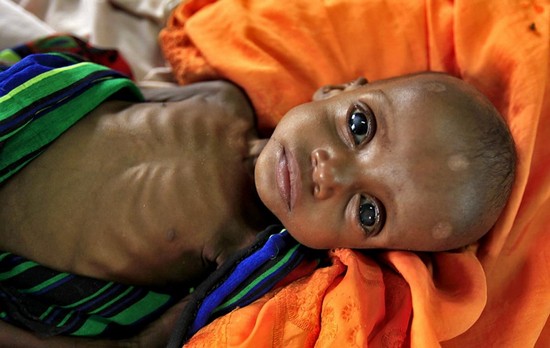 Somalia - Diary of a Child Specialist volunteering in Mogadishu